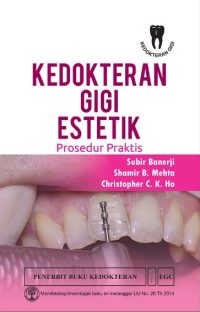 Kedokteran Gigi Estetik Prosedur Praktis
