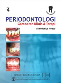 Periodontologi Gambaran Klinis & Terapi, Ed. 4
