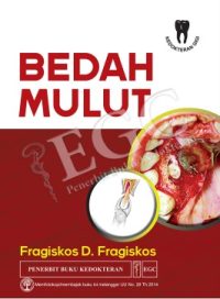 Bedah Mulut