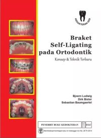 Brak Self-Liganting Pada Ortodontik Konsep & Teknik Terbaru