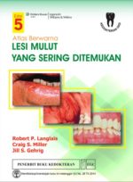 Atlas-Berwarna-Lesi-Mulut-Yang-Sering-Ditemukan-Ed.-5